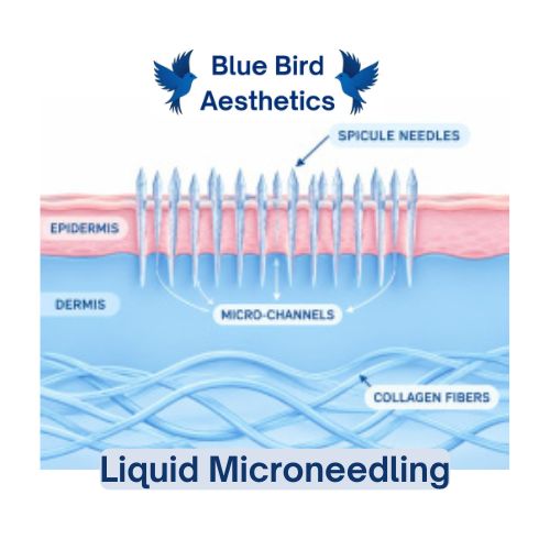 Cross‑section diagram of skin showing spicule needles creating micro‑channels through the epidermis and dermis to stimulate collagen.